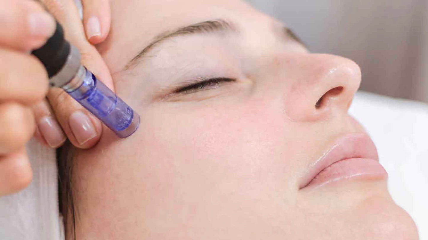 Formation Microneedling en ligne