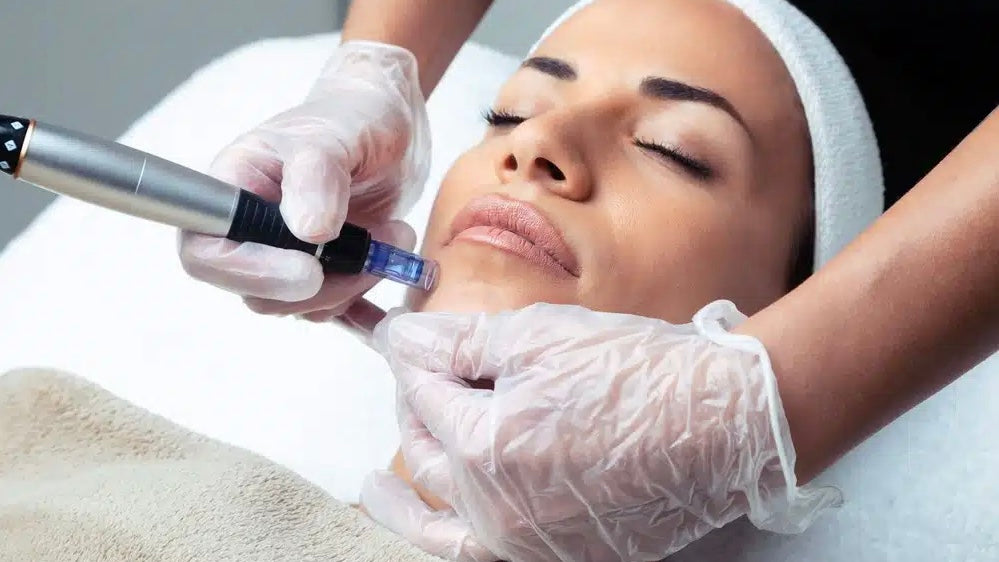 Formation Microneedling en ligne